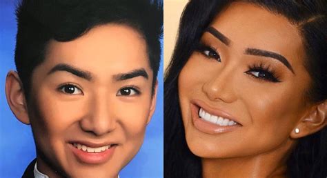 nikita dragun before|Nikita Draguns Plastic Surgery Journey — Before and。